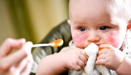 Çocuklarda besin alerjisinde ilk üç